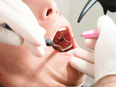 歯周病チェック