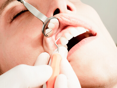 お口のクリーニング